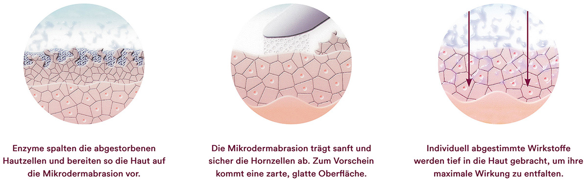 Mikroderm Grafik